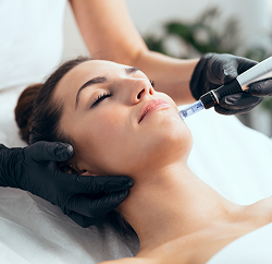 Microneedling Treatment